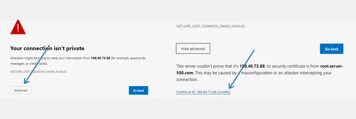 Browser privacy warning with the Advanced button and the Continue to the server IP address link highlighted